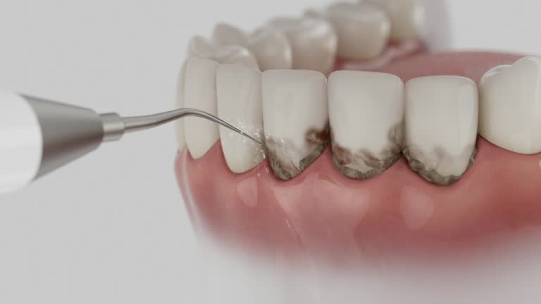 Trusted Dental Crowns And Bridges service in Cotati, CA - Dentist Open Now